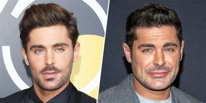 Can Someone Please Explain WTF Zac Efron Did to His Beautiful, Beautiful Face?