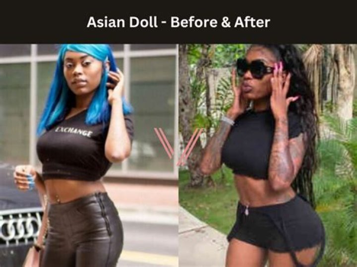 Did Kimbella plastic surgery? – Celebrity.fm – #1 Official Stars, Business & People Network, Wiki, Success story, Biography & Quotes