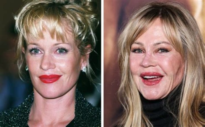 Face Off12 Celebrities Who’ve Had So Much Work Done, We Don’t Remember Their Old Face