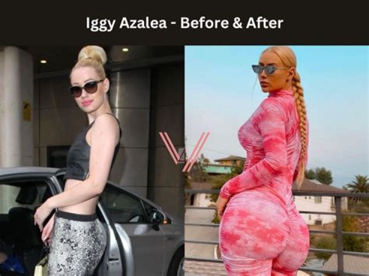 Iggy Azalea Responds To Comments About Her Twerking: "Your Man 100% Wants To F*ck Me"