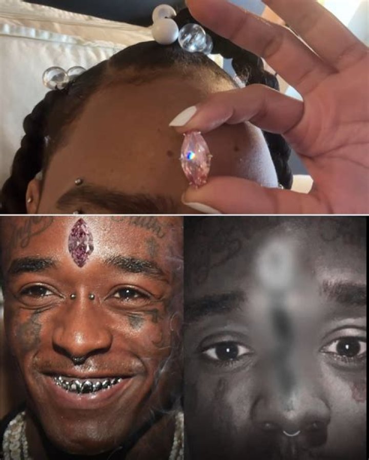 Lil Uzi Vert's Forehead Diamond Is Gone