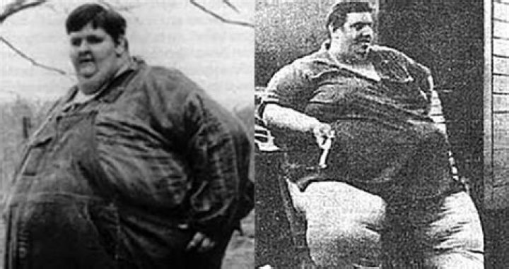 Meet Jon Brower Minnoch, The Heaviest Person In The World