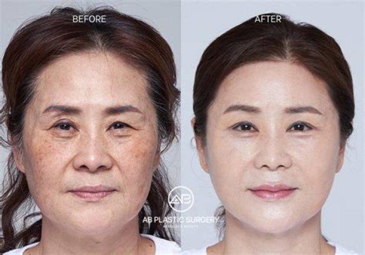 WTFThis Plastic Surgery Makeover Show from South Korea is INSANE